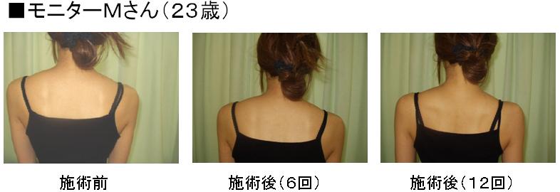 ◎ｳｪﾙﾈｽ整体院<br />
<br />
肩幅矯正･肩幅狭小矯正･姿勢矯正の専門整体院｡<br />
開院18年の実績｡(2001年開院)<br />
肩幅は､ﾌﾟﾛﾎﾟｰｼｮﾝの大切な要素の1つです｡<br />
肩幅が広い､巻き肩､いかり肩､猫背､等が気になる方は､当院独自の矯正法で､<br />
肩幅を少し狭くし､ﾅﾁｭﾗﾙな女性らしいｼｮﾙﾀﾞｰﾗｲﾝと､きれいな背姿を実現します｡