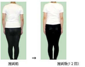 ◎ｳｪﾙﾈｽ整体院<br />
<br />
肩幅矯正･肩幅狭小矯正･姿勢矯正の専門整体院｡<br />
開院18年の実績｡(2001年開院)<br />
肩幅は､ﾌﾟﾛﾎﾟｰｼｮﾝの大切な要素の1つです｡<br />
肩幅が広い､巻き肩､いかり肩､猫背､等が気になる方は､当院独自の矯正法で､<br />
肩幅を少し狭くし､ﾅﾁｭﾗﾙな女性らしいｼｮﾙﾀﾞｰﾗｲﾝと､きれいな背姿を実現します｡
