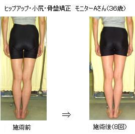 ◎ｳｪﾙﾈｽ整体院<br />
<br />
肩幅矯正･肩幅狭小矯正･姿勢矯正の専門整体院｡<br />
開院18年の実績｡(2001年開院)<br />
肩幅は､ﾌﾟﾛﾎﾟｰｼｮﾝの大切な要素の1つです｡<br />
肩幅が広い､巻き肩､いかり肩､猫背､等が気になる方は､当院独自の矯正法で､<br />
肩幅を少し狭くし､ﾅﾁｭﾗﾙな女性らしいｼｮﾙﾀﾞｰﾗｲﾝと､きれいな背姿を実現します｡